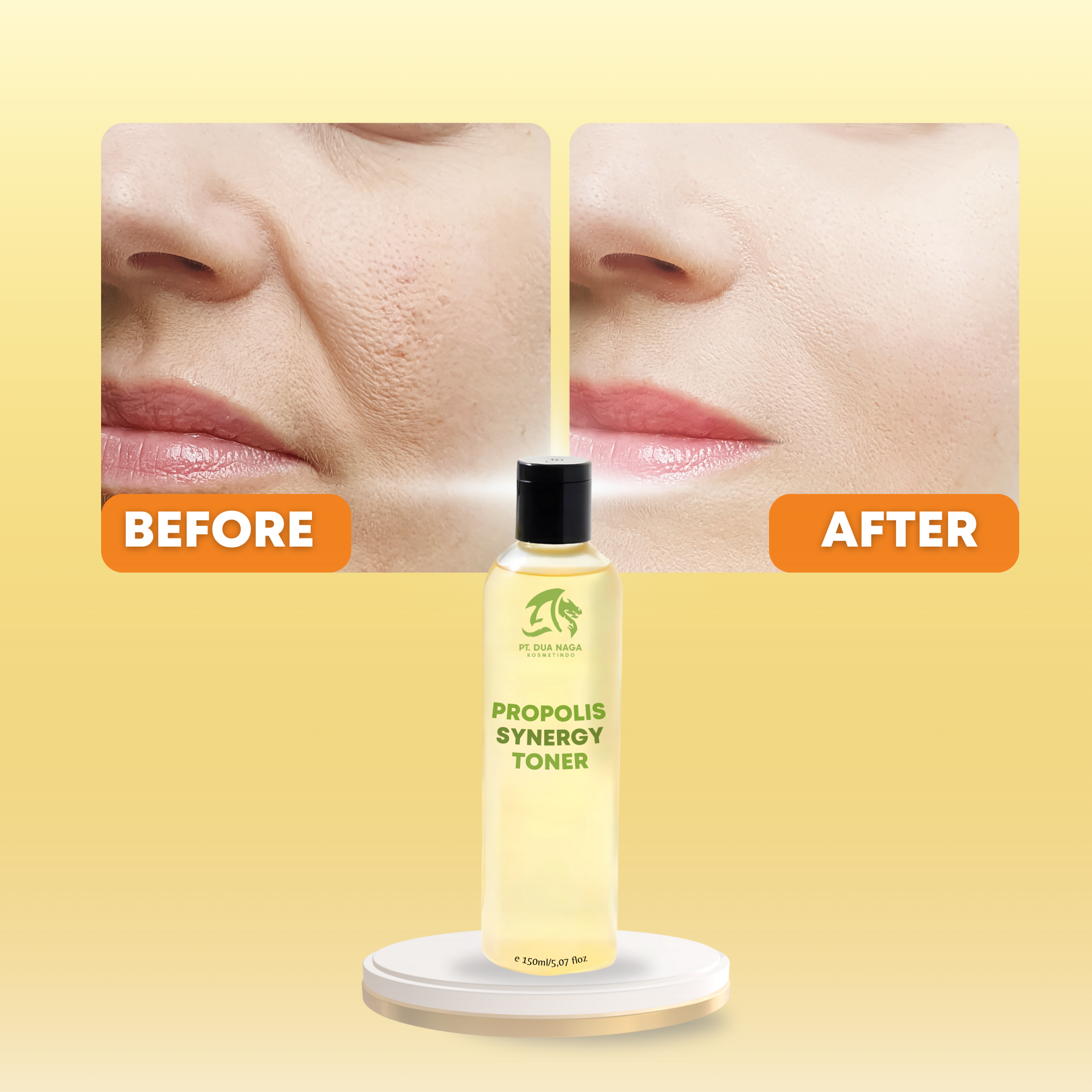 Propolis extract and 10% Honey extract Skin Toner